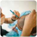 Best hair transplant in delhi