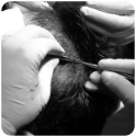 Best hair transplant in delhi