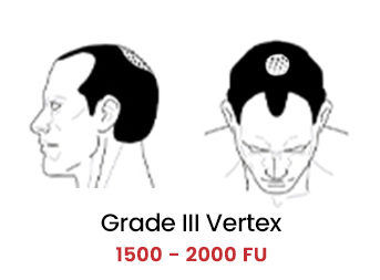 Grade4