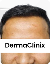 Before-after-images
