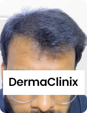 Before-after-images