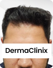 Before-after-images