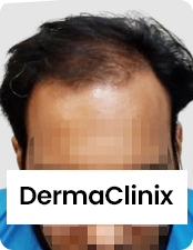 Before-after-images