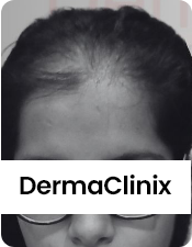 Before-after-images