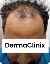 Before-after-images
