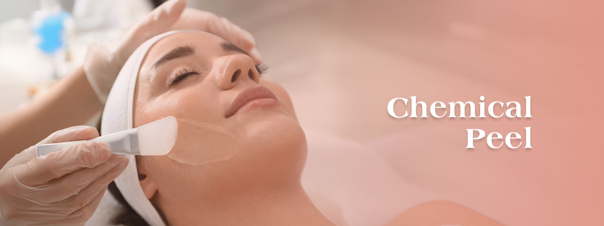 Chemical peel banner