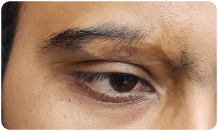 area-botox-section