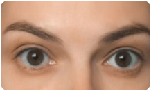 area-botox-section
