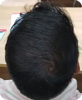 Before After Result