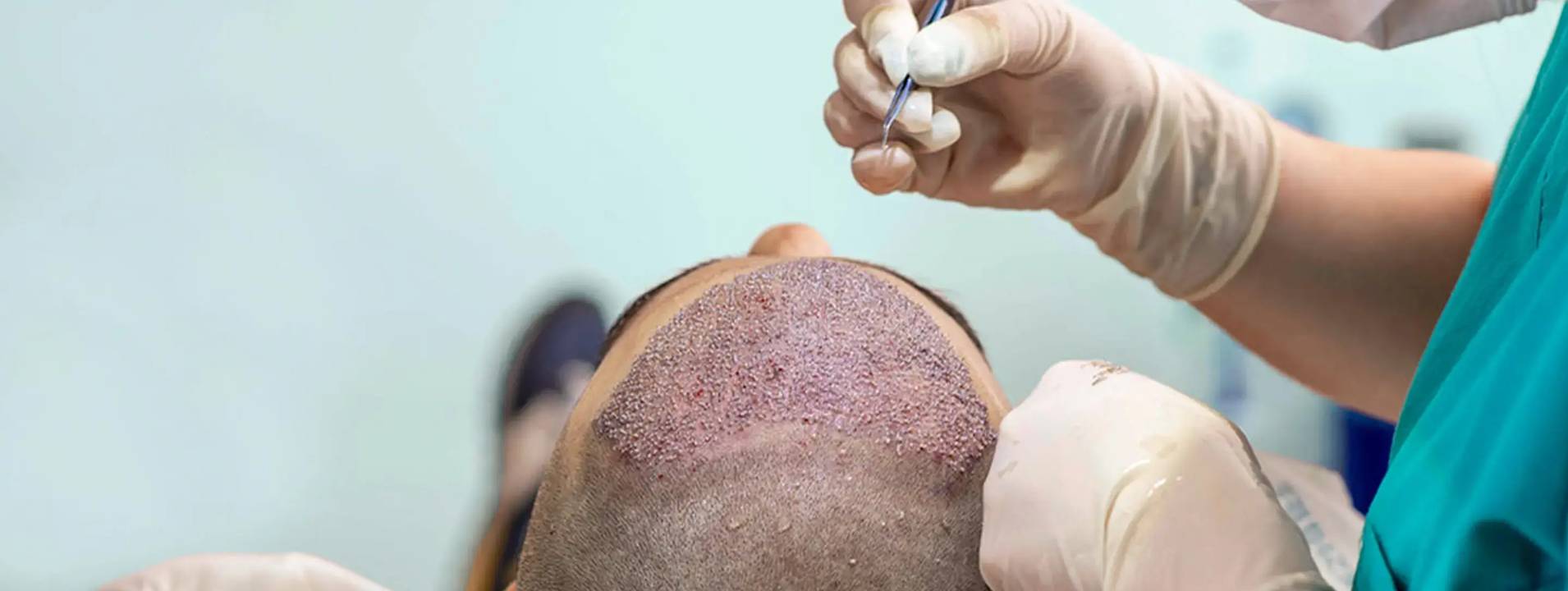 HD-PRP Therapy