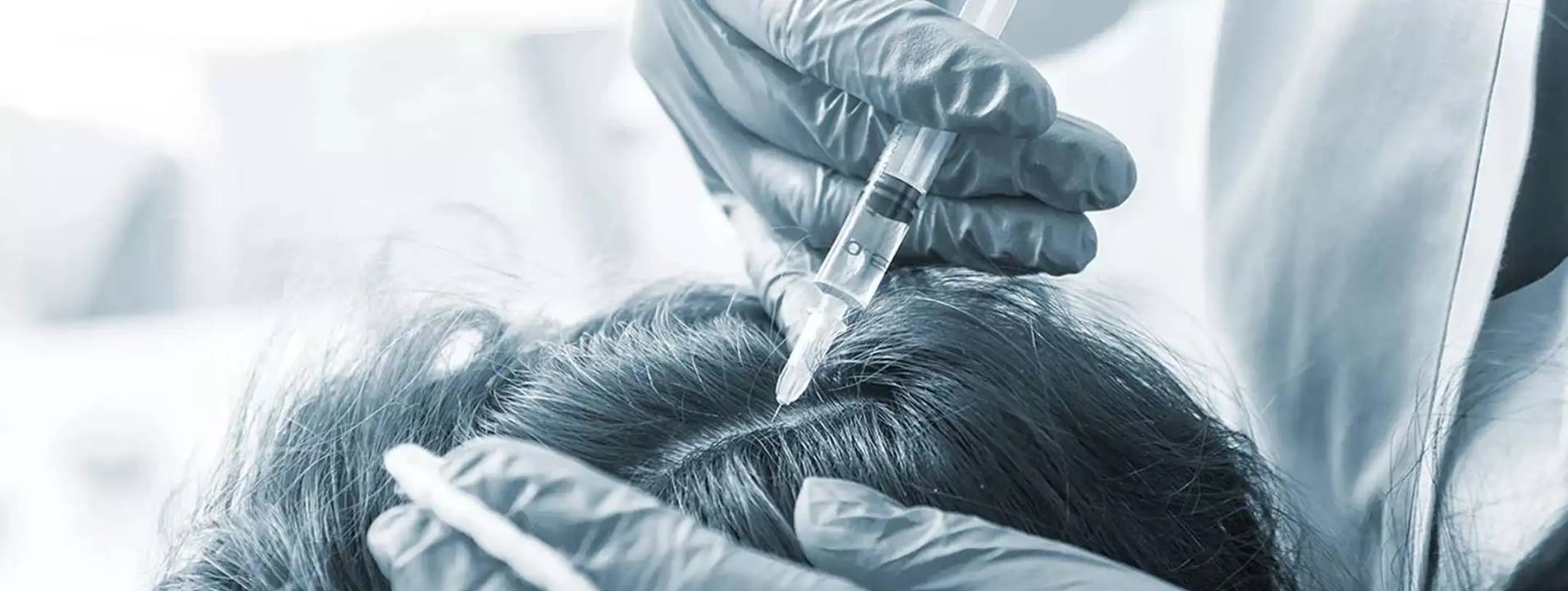HD-PRP Therapy